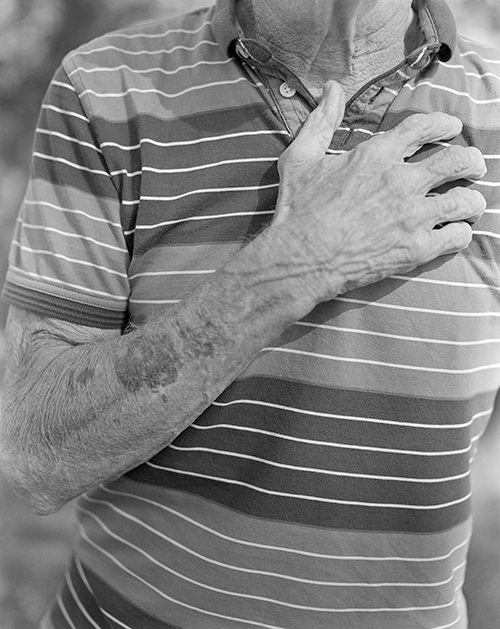 Black and white photo of an elderly man's arm crossed over his chest.